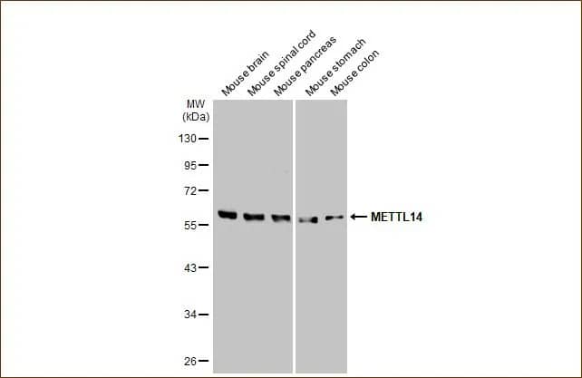 METTL14 Antibody (HL1816) - Azide and BSA Free