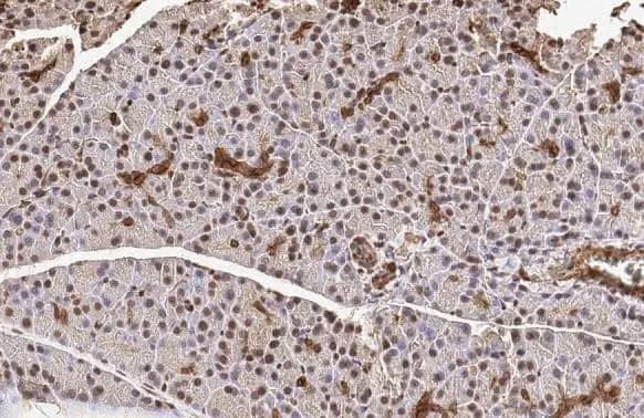 METTL14 Antibody (HL1816) - Azide and BSA Free