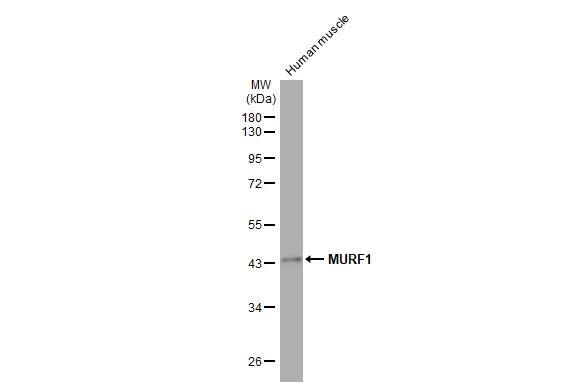 MuRF1/TRIM63 Antibody (HL1450) - Azide and BSA Free