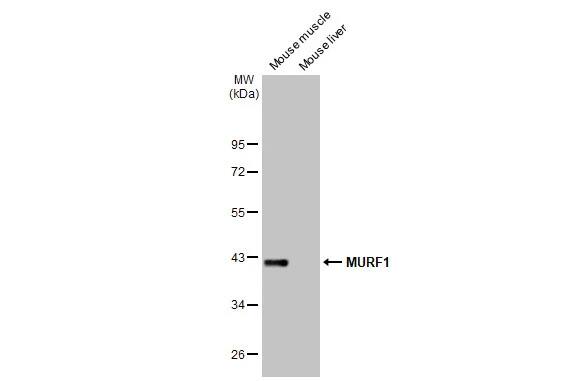 MuRF1/TRIM63 Antibody (HL1450) - Azide and BSA Free