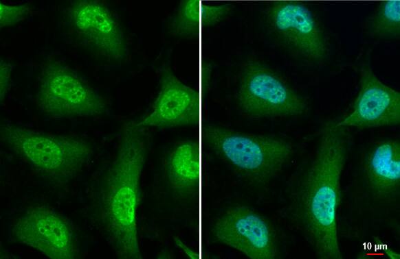 Nurr1/NGFI-B beta/NR4A2 Antibody (HL1852) - Azide and BSA Free