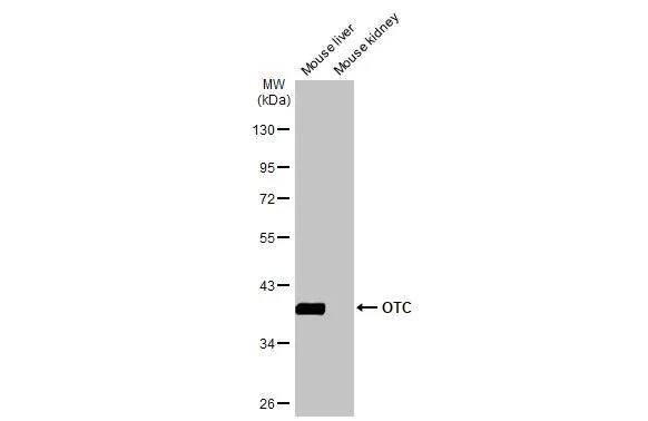 Ornithine Carbamoyltransferase Antibody (HL2122) - Azide and BSA Free