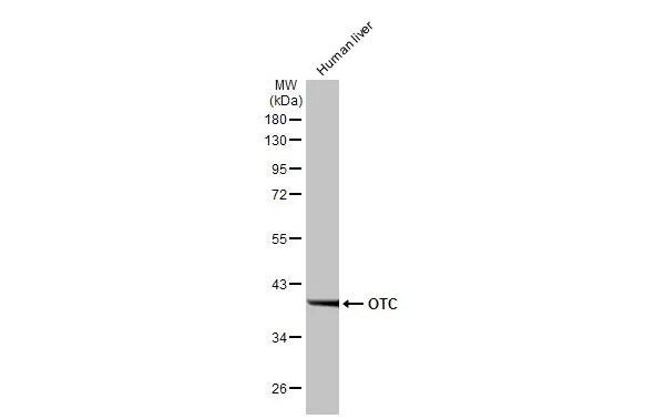 Ornithine Carbamoyltransferase Antibody (HL2122) - Azide and BSA Free