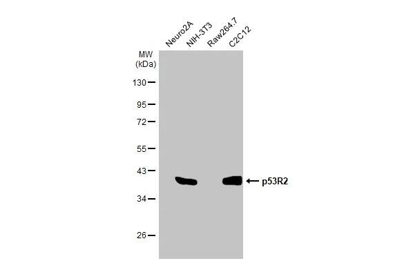 p53R2 Antibody (HL1400) - Azide and BSA Free