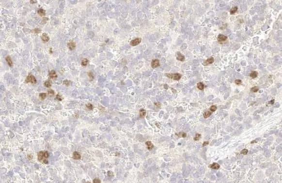 p53R2 Antibody (HL1400) - Azide and BSA Free