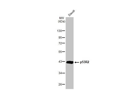 p53R2 Antibody (HL1400) - Azide and BSA Free