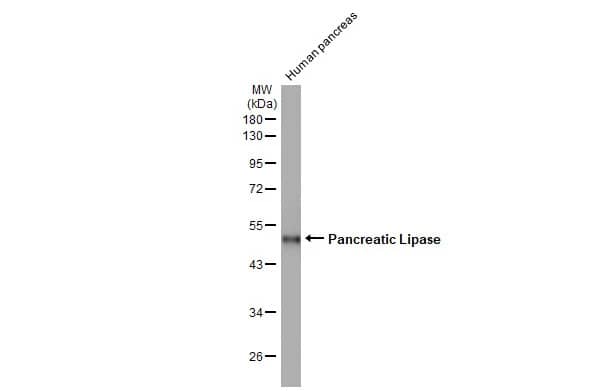 Pancreatic Lipase Antibody (HL1310) - Azide and BSA Free