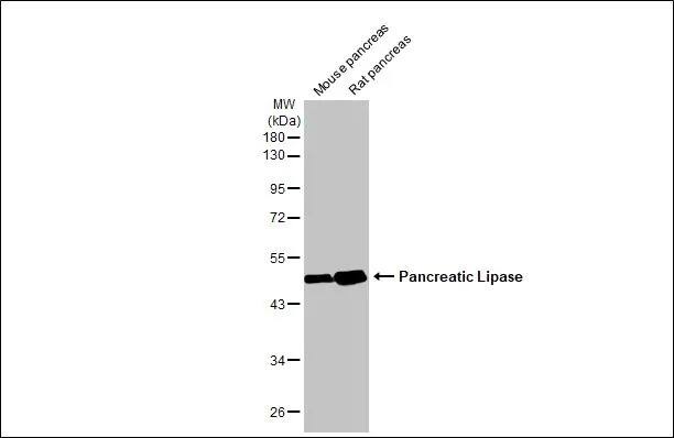 Pancreatic Lipase Antibody (HL1310) - Azide and BSA Free