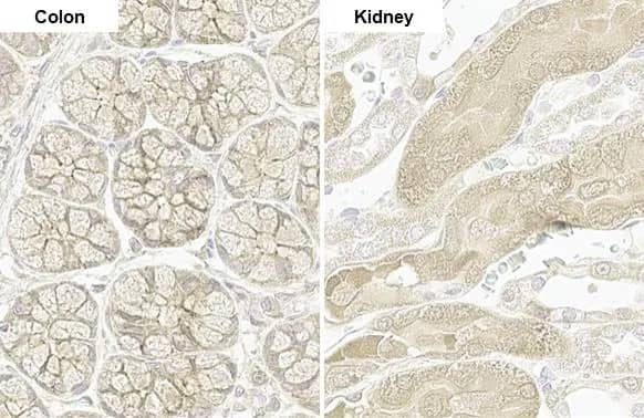 PARP14 Antibody (HL1178) - Azide and BSA Free
