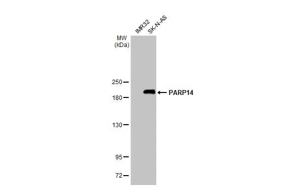 PARP14 Antibody (HL1178) - Azide and BSA Free