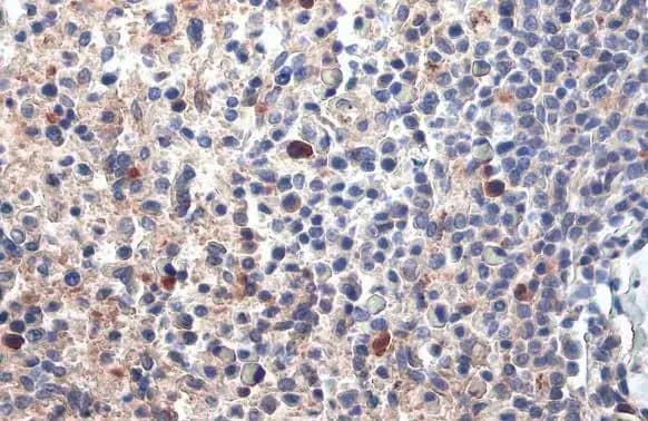PARP14 Antibody (HL1178) - Azide and BSA Free