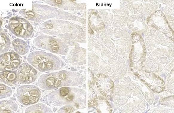 PARP14 Antibody (HL1178) - Azide and BSA Free