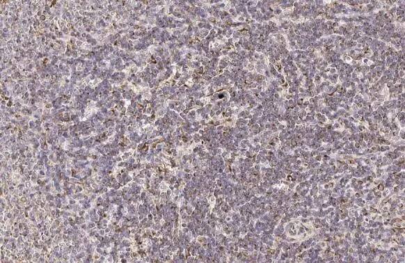 PFKFB4 Antibody (HL2204) - Azide and BSA Free