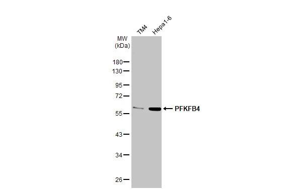 PFKFB4 Antibody (HL2204) - Azide and BSA Free