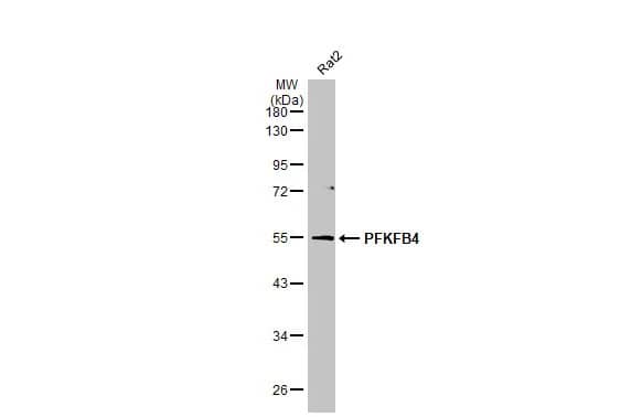 PFKFB4 Antibody (HL2204) - Azide and BSA Free