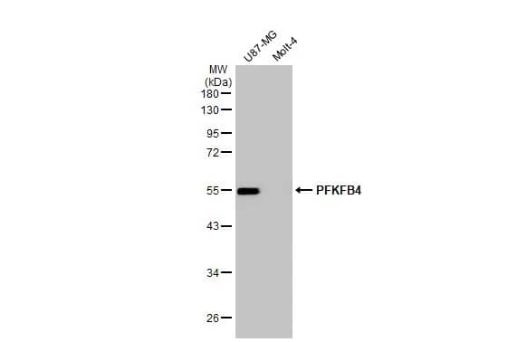 PFKFB4 Antibody (HL2204) - Azide and BSA Free