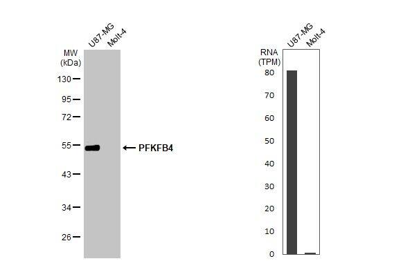 PFKFB4 Antibody (HL2204) - Azide and BSA Free