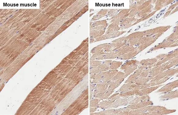 Muscle Phosphofructokinase/PFKM/PFK-1 Antibody (HL2010) - Azide and BSA Free