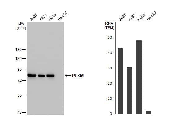 Muscle Phosphofructokinase/PFKM/PFK-1 Antibody (HL2010) - Azide and BSA Free