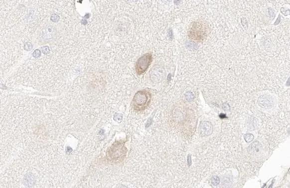 PIK3C2A Antibody (HL1612) - Azide and BSA Free