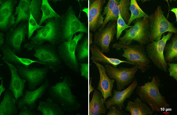 pan PKC [p Thr410] Antibody (HL1279) - Azide and BSA Free