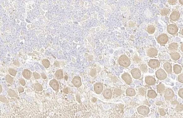 pan PKC [p Thr410] Antibody (HL1279) - Azide and BSA Free