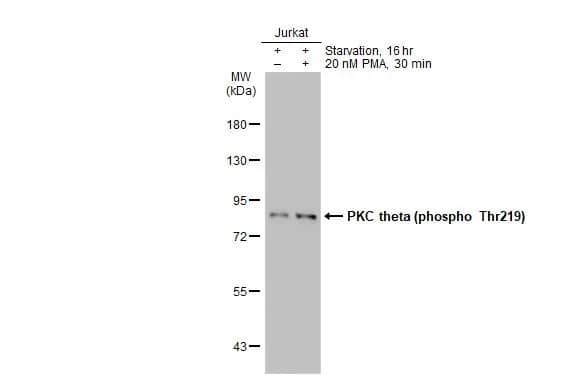 PKC theta [p Thr219] Antibody (HL1157) - Azide and BSA Free