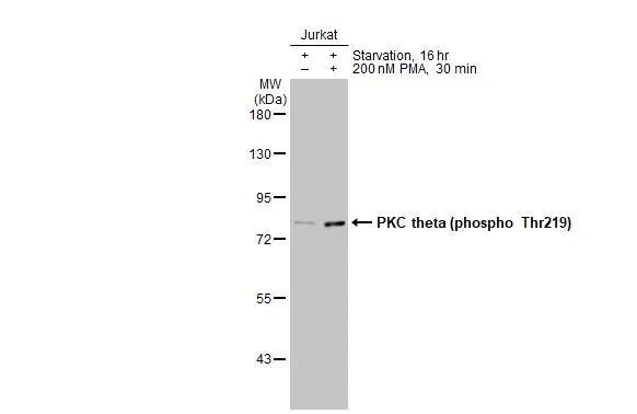 PKC theta [p Thr219] Antibody (HL1157) - Azide and BSA Free