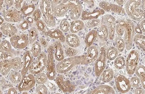 PP2A alpha Antibody (HL1447) - Azide and BSA Free