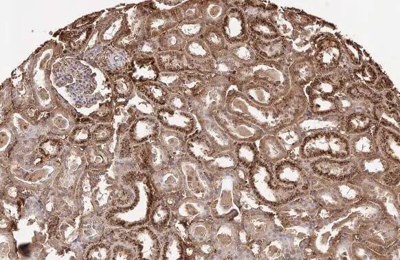 Transthyretin/Prealbumin Antibody (HL1823) - Azide and BSA Free