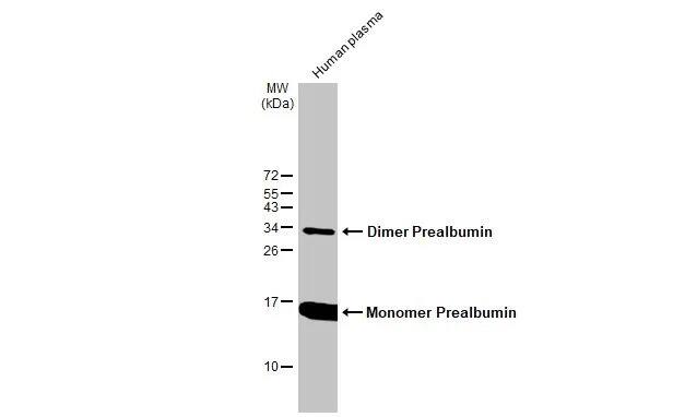 Transthyretin/Prealbumin Antibody (HL1823) - Azide and BSA Free