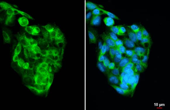 Transthyretin/Prealbumin Antibody (HL1823) - Azide and BSA Free