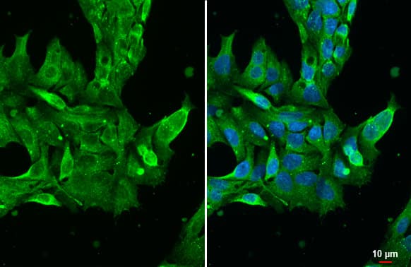 Transthyretin/Prealbumin Antibody (HL1823) - Azide and BSA Free