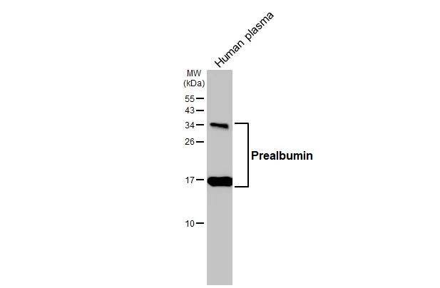 Transthyretin/Prealbumin Antibody (HL1823) - Azide and BSA Free