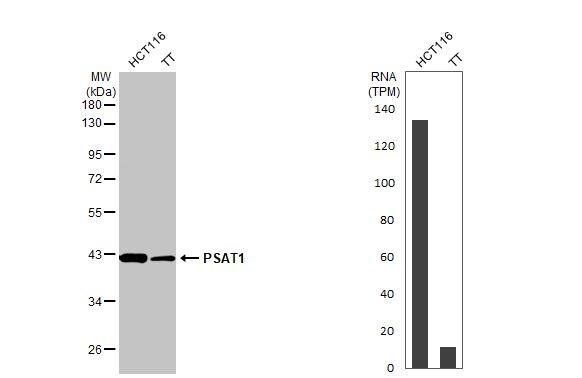 PSAT1 Antibody (HL2270) - Azide and BSA Free