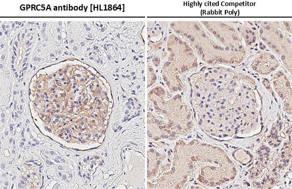 GPRC5A/RAI3 Antibody (HL1864) - Azide and BSA Free