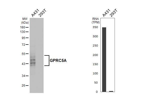 GPRC5A/RAI3 Antibody (HL1864) - Azide and BSA Free