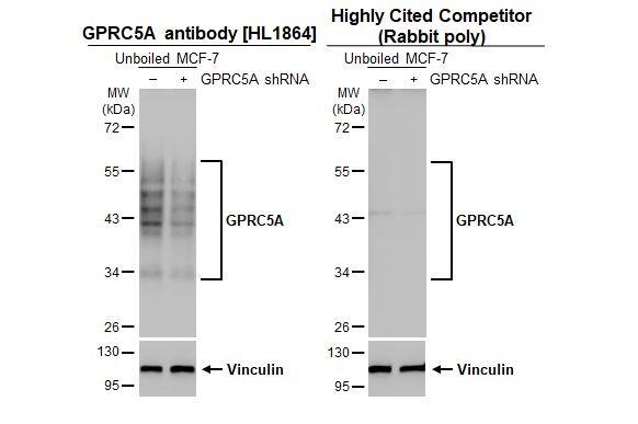 GPRC5A/RAI3 Antibody (HL1864) - Azide and BSA Free