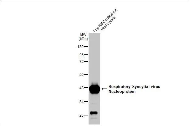 Respiratory Syncytial Virus Nucleoprotein Antibody (HL1246) - Azide and BSA Free