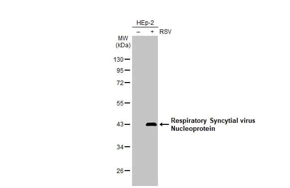 Respiratory Syncytial Virus Nucleoprotein Antibody (HL1246) - Azide and BSA Free