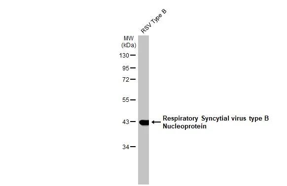 Respiratory Syncytial Virus Nucleoprotein Antibody (HL1247) - Azide and BSA Free