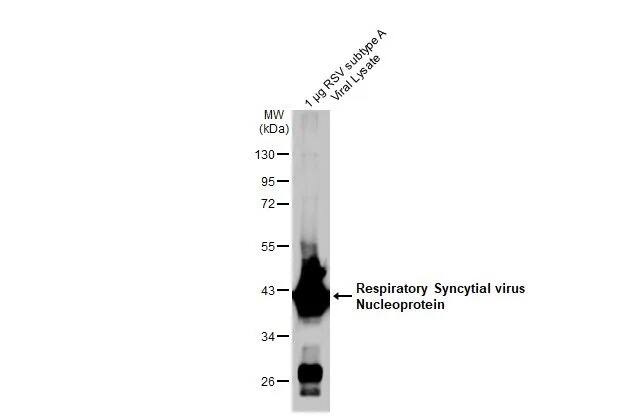 Respiratory Syncytial Virus Nucleoprotein Antibody (HL1247) - Azide and BSA Free