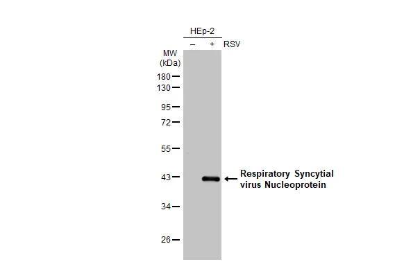 Respiratory Syncytial Virus Nucleoprotein Antibody (HL1247) - Azide and BSA Free