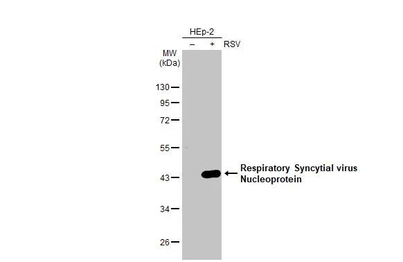 Respiratory Syncytial Virus Nucleoprotein Antibody (HL1248) - Azide and BSA Free