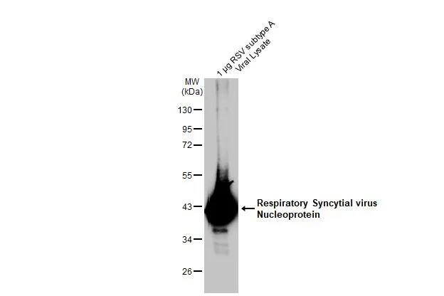 Respiratory Syncytial Virus Nucleoprotein Antibody (HL1295) - Azide and BSA Free