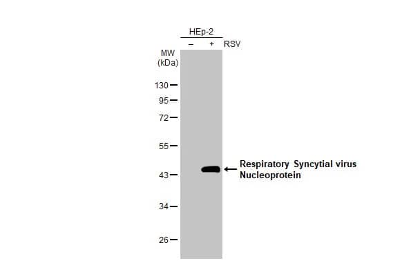 Respiratory Syncytial Virus Nucleoprotein Antibody (HL1295) - Azide and BSA Free