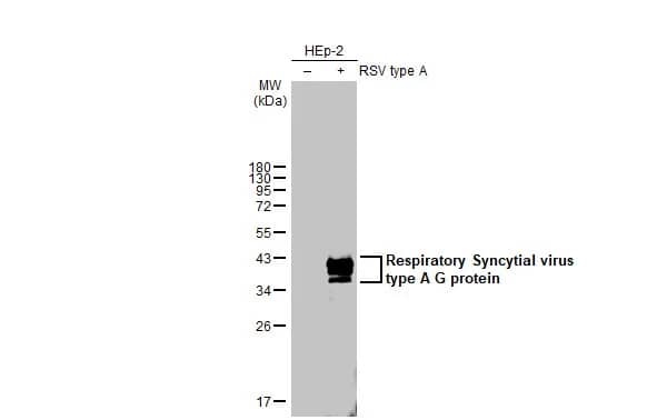 Respiratory Syncytial Virus Glycoprotein G Antibody (HL2354) - Azide and BSA Free
