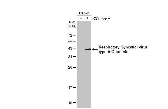 Respiratory Syncytial Virus Glycoprotein G Antibody (HL2354) - Azide and BSA Free