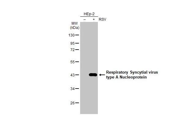 Respiratory Syncytial Virus Nucleoprotein Antibody (HL1297) - Azide and BSA Free