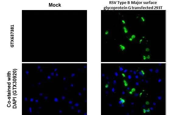 Respiratory Syncytial Virus Glycoprotein G Antibody (HL1733) - Azide and BSA Free